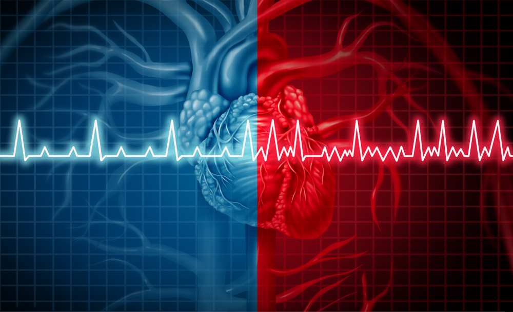 Übermäßiger Stress kann Herzrhythmusstörungen verursachen – eine Regulation des Kalium-Haushaltes nach Dr. Schüssler kann diese “Zell-Blockade” durchbrechen.